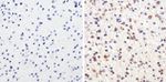 Tau Antibody in Immunohistochemistry (Paraffin) (IHC (P))