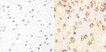 Tau Antibody in Immunohistochemistry (Paraffin) (IHC (P))