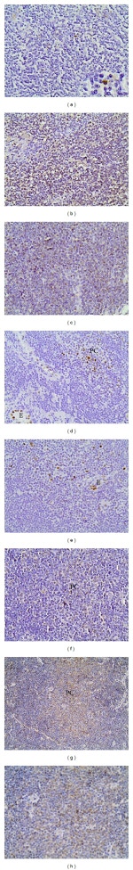 IL-8 (CXCL8) Antibody in Immunohistochemistry (Paraffin) (IHC (P))