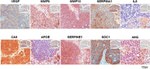 IL-8 (CXCL8) Antibody in Immunohistochemistry (Paraffin) (IHC (P))