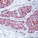 c-Myc Antibody in Immunohistochemistry (Paraffin) (IHC (P))