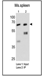 Fyn Antibody in Immunoprecipitation (IP)