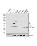 EIF2S1 Antibody in Western Blot (WB)