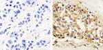 STAT1 Antibody in Immunohistochemistry (Paraffin) (IHC (P))