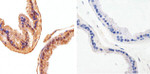 AKT1 Antibody in Immunohistochemistry (Paraffin) (IHC (P))