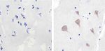 SRC Antibody in Immunohistochemistry (Paraffin) (IHC (P))