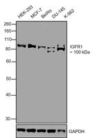 IGF1R beta Antibody in Western Blot (WB)