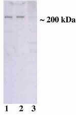 TSC2 Antibody in Western Blot (WB)