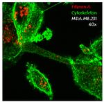 Filamin A Antibody in Immunocytochemistry (ICC/IF)