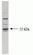 TGFBR1 Antibody in Western Blot (WB)