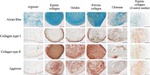 Aggrecan Antibody in Immunohistochemistry (IHC)