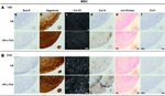 Aggrecan Antibody in Immunohistochemistry (Paraffin) (IHC (P))