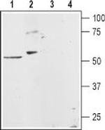 Histamine H1 Receptor (HRH1) Antibody in Western Blot (WB)