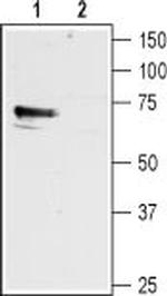 Histamine H1 Receptor (HRH1) Antibody in Western Blot (WB)