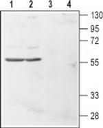 Histamine H4 Receptor (HRH4) (extracellular) Antibody in Western Blot (WB)