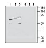 Histamine H1 Receptor/HRH1 (extracellular) Antibody in Western Blot (WB)