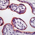 INSR alpha Antibody in Immunohistochemistry (Paraffin) (IHC (P))