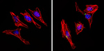 INSR beta Antibody in Immunocytochemistry (ICC/IF)