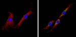 INSR beta Antibody in Immunocytochemistry (ICC/IF)