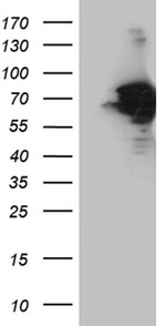 AIFM1 Antibody in Western Blot (WB)