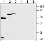 Presenilin-1 Antibody in Western Blot (WB)