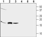 GABARAP Antibody in Western Blot (WB)