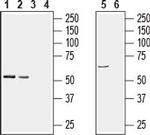 PACSIN1 Antibody in Western Blot (WB)