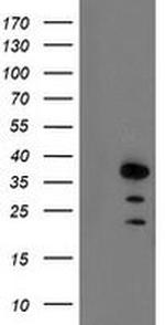 AIP Antibody in Western Blot (WB)