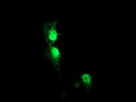 AIPL1 Antibody in Immunocytochemistry (ICC/IF)