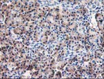 AIPL1 Antibody in Immunohistochemistry (Paraffin) (IHC (P))