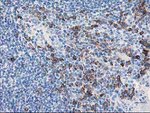 AIPL1 Antibody in Immunohistochemistry (Paraffin) (IHC (P))