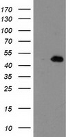 AIPL1 Antibody in Western Blot (WB)