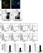 AIRE Antibody in Immunohistochemistry (IHC)