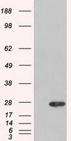 AK1 Antibody in Western Blot (WB)