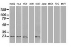 AK1 Antibody in Western Blot (WB)