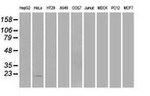 AK1 Antibody in Western Blot (WB)