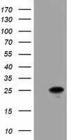 AK3 Antibody in Western Blot (WB)