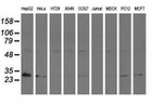 AK3 Antibody in Western Blot (WB)