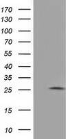 AK3 Antibody in Western Blot (WB)