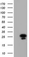 AK3 Antibody in Western Blot (WB)