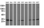 AK3 Antibody in Western Blot (WB)