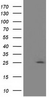 AK3 Antibody in Western Blot (WB)