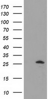 AK3 Antibody in Western Blot (WB)