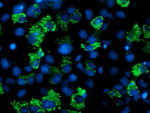 AK4 Antibody in Immunocytochemistry (ICC/IF)