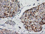 AK4 Antibody in Immunohistochemistry (Paraffin) (IHC (P))