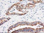 AK4 Antibody in Immunohistochemistry (Paraffin) (IHC (P))