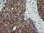 AK4 Antibody in Immunohistochemistry (Paraffin) (IHC (P))