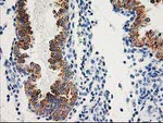 AK4 Antibody in Immunohistochemistry (Paraffin) (IHC (P))