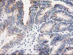 AK4 Antibody in Immunohistochemistry (Paraffin) (IHC (P))