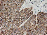 AK4 Antibody in Immunohistochemistry (Paraffin) (IHC (P))